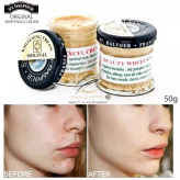 کرم سفید کننده و ضدلک قوی دالفور اصل Dalfour beauty cream